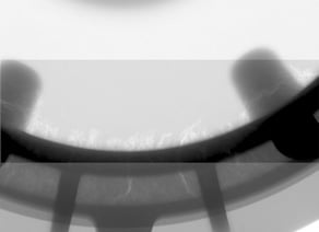 defectogram defectogram